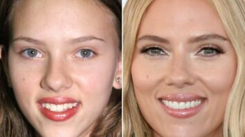 The Art of Subtlety: Celebrities' Most Discreet Plastic Surgeries